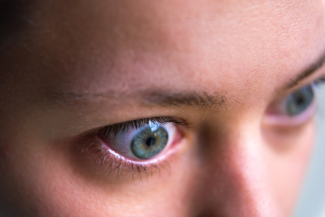 Frau mit hervorstehenden Augen