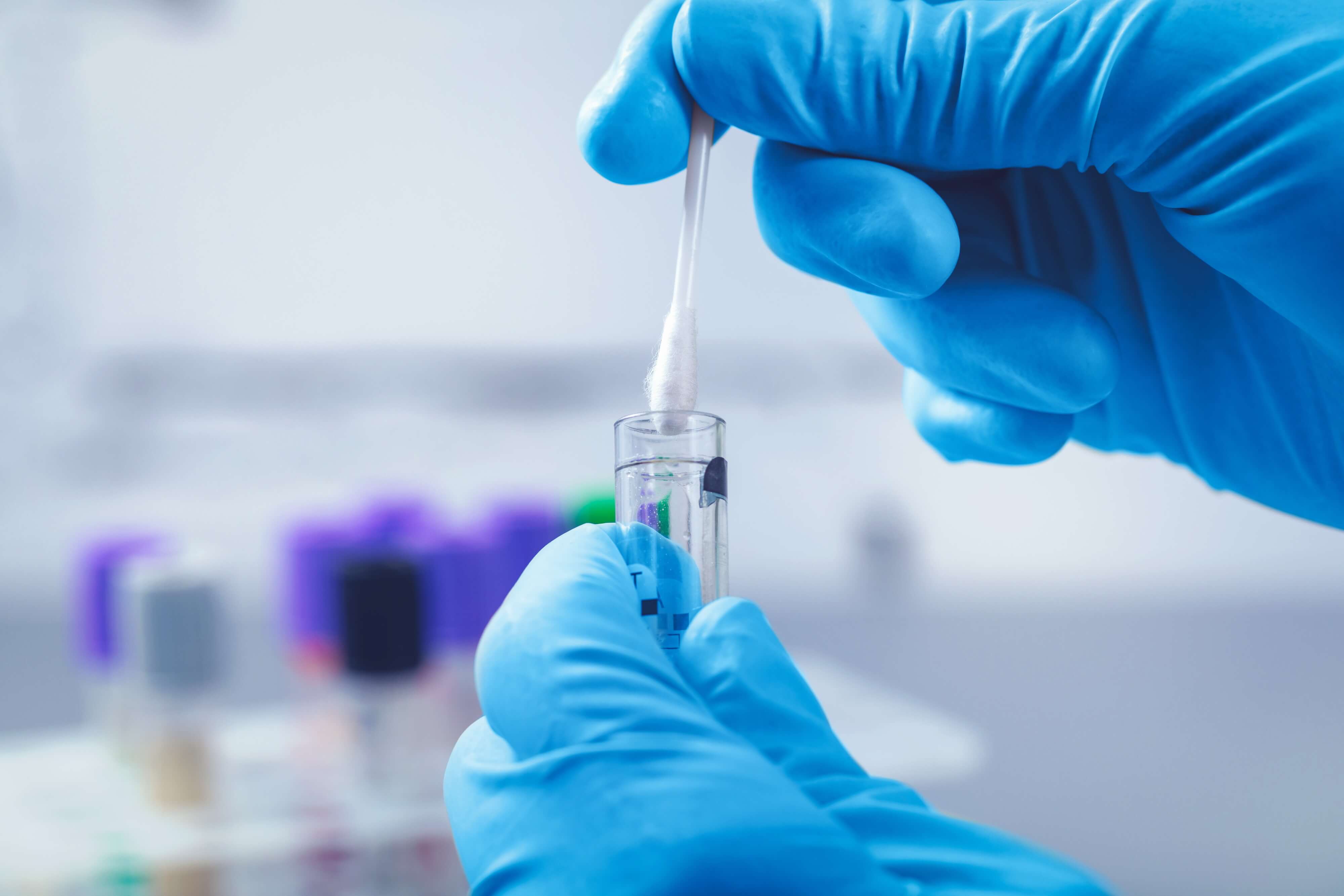  Stoffwechselanalyse – richtig ernähren dank DNA-Test? 